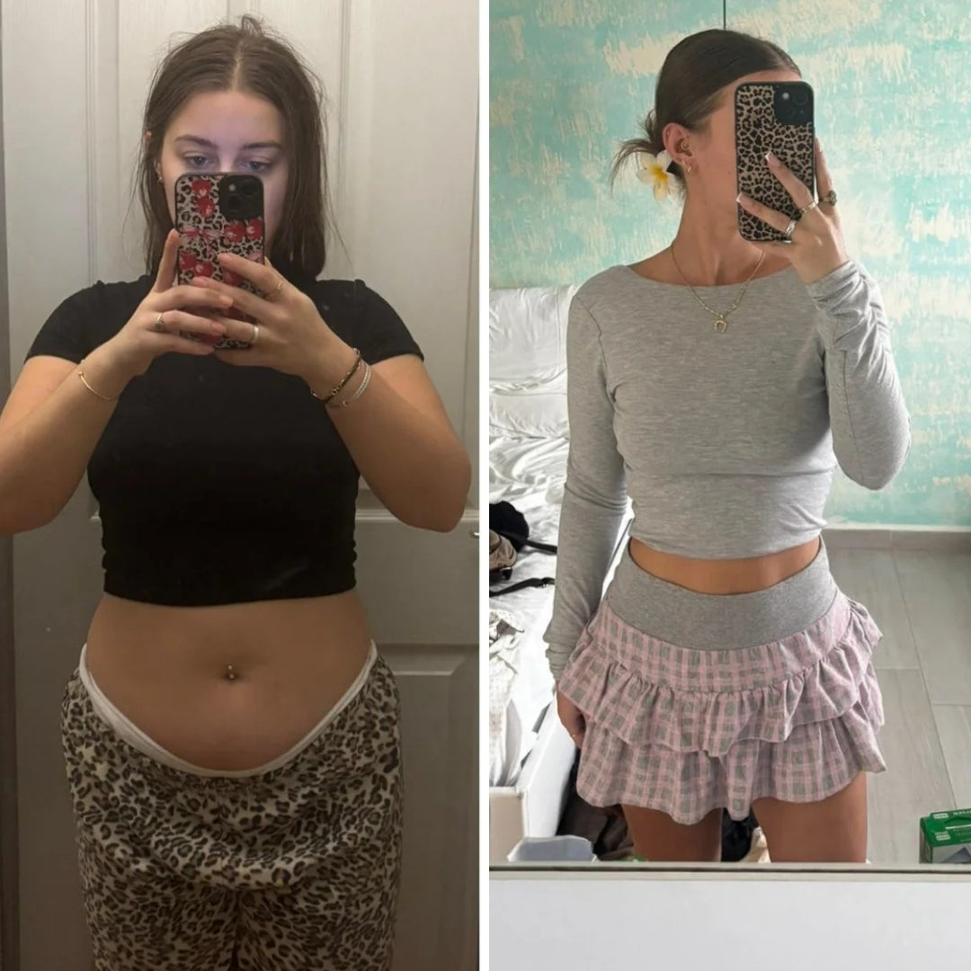 Parches de berberina 3 en 1 - Reduce hasta 8kg en 90 días sin pastillas.
