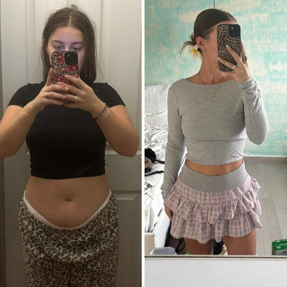 Parches de berberina 3 en 1 - Reduce hasta 8kg en 90 días sin pastillas.